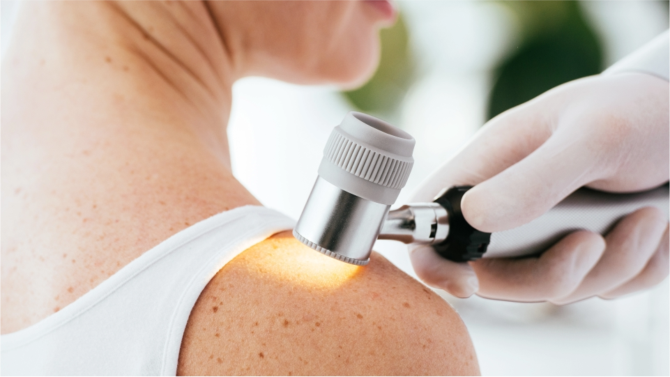 Dermatología