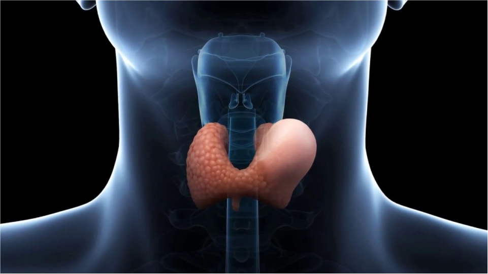 Cáncer de tiroides